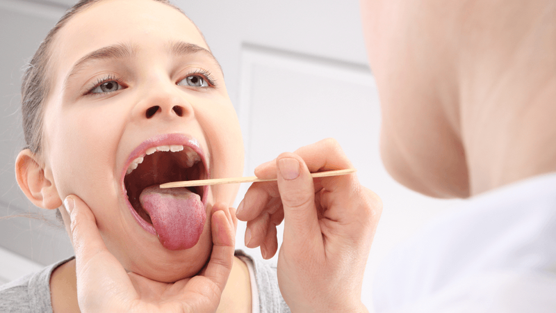 Giải đáp: Cắt amidan có ảnh hưởng đến giọng nói không? 2