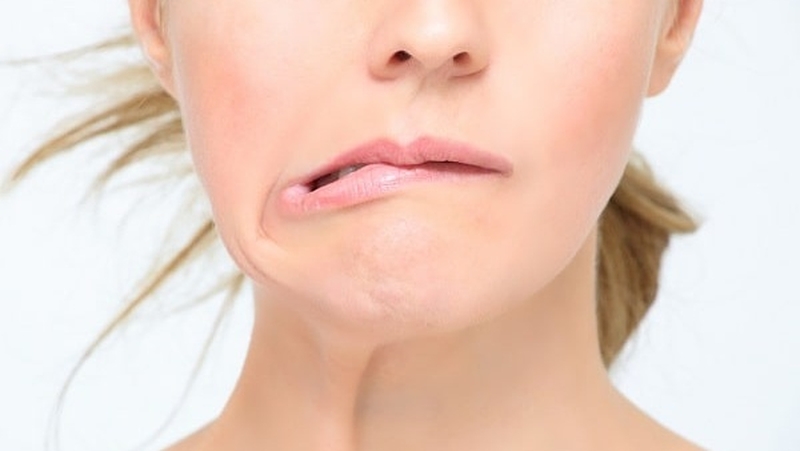 Bệnh liệt mặt vẫn có thể điều trị nếu được phát hiện kịp thời