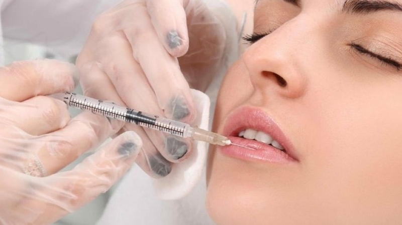 Tiêm filler là phương pháp làm đẹp được ưa chuộng hiện nay