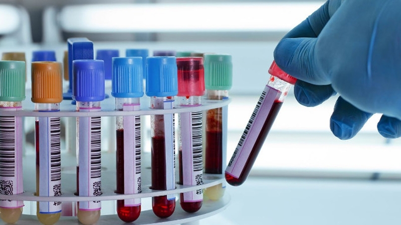 Giải đáp: Lấy máu xét nghiệm bao nhiêu cc là đủ 3