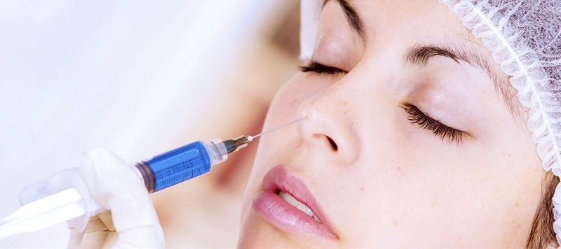 Giải đáp: Nâng mũi filler bao nhiêu tiền và có những loại filler nào 2