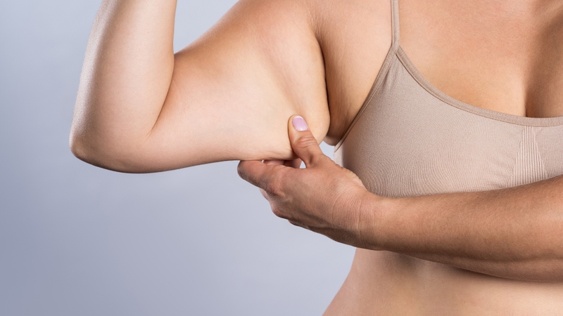 Giải đáp ngay: Mỡ nách bẩm sinh có giảm được không? 4