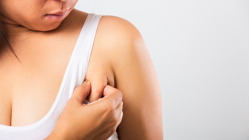 Giải đáp ngay: Mỡ nách bẩm sinh có giảm được không? 1