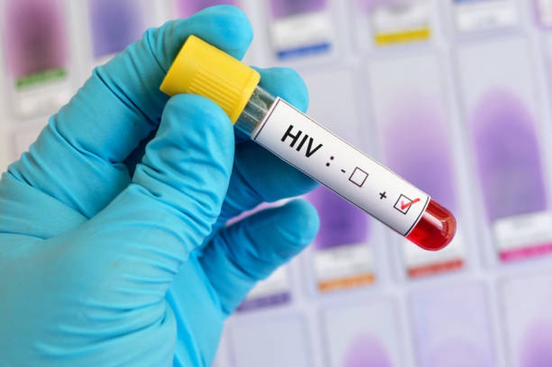 Giải đáp: Người mắc bệnh nấm miệng có bị HIV không? 2