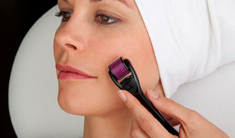 Giải đáp những thắc mắc về lăn kim trị mụn và lưu ý sau khi điều trị 1