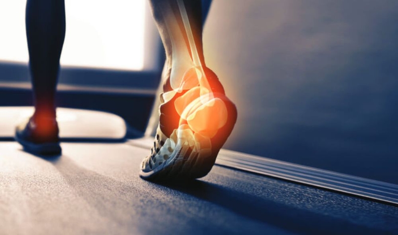 Giải đáp: Rạn xương bàn chân bao lâu thì khỏi? 1