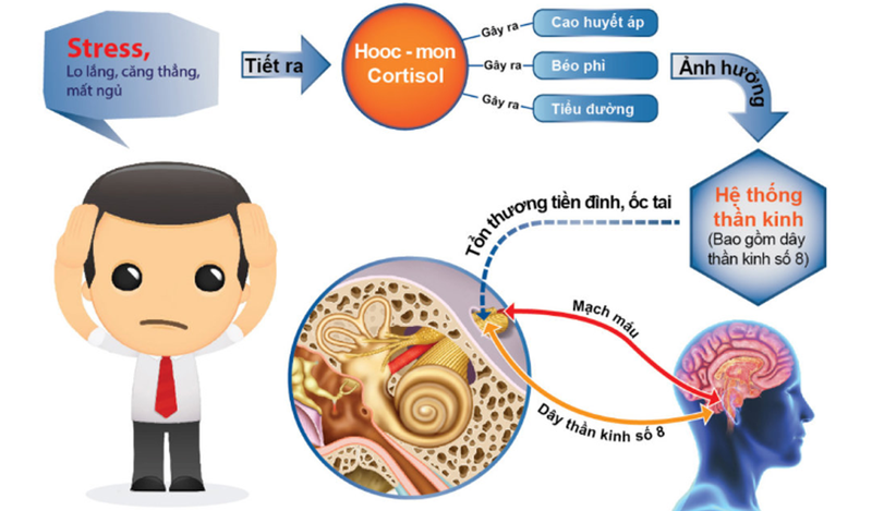 Căng thẳng, stress, thiếu máu có thể dẫn đến rối loạn tiền đình