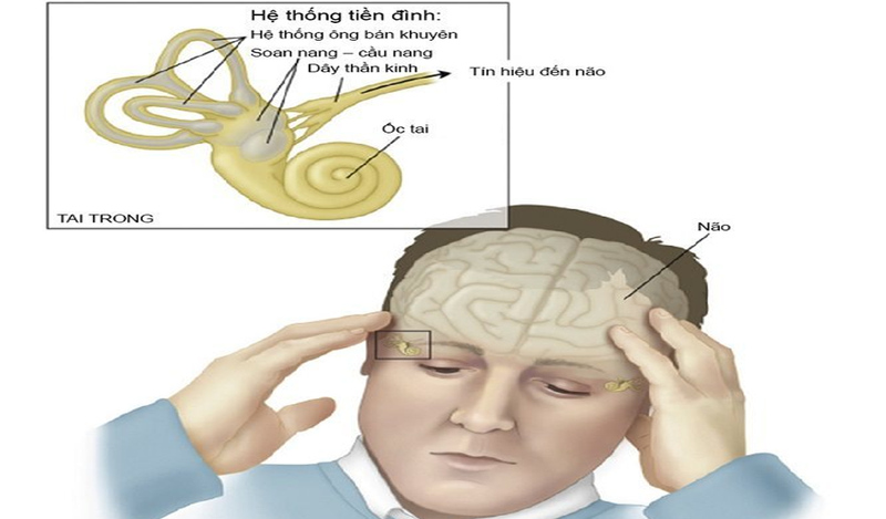 Nguyên nhân rối loạn tiền đình? Bệnh rối loạn tiền đình có nguy hiểm không?