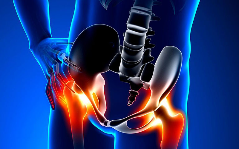 Giải đáp thắc mắc: Căng cơ háng phải làm sao? 2