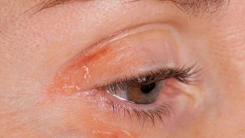 Giải đáp thắc mắc: Cho con bú phun mày được không 3