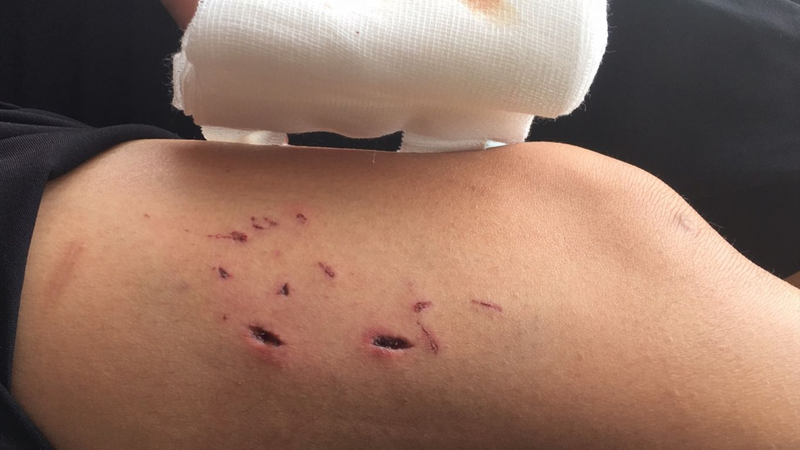 Giải đáp thắc mắc: Chó không bị dại cắn có sao không? 2