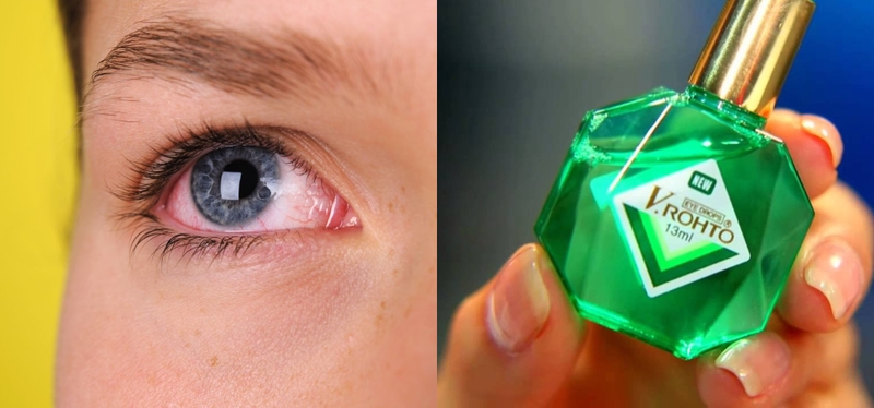 giai-dap-thac-mac-dau-mat-do-nho-v-rohto-duoc-khong 3.jpg