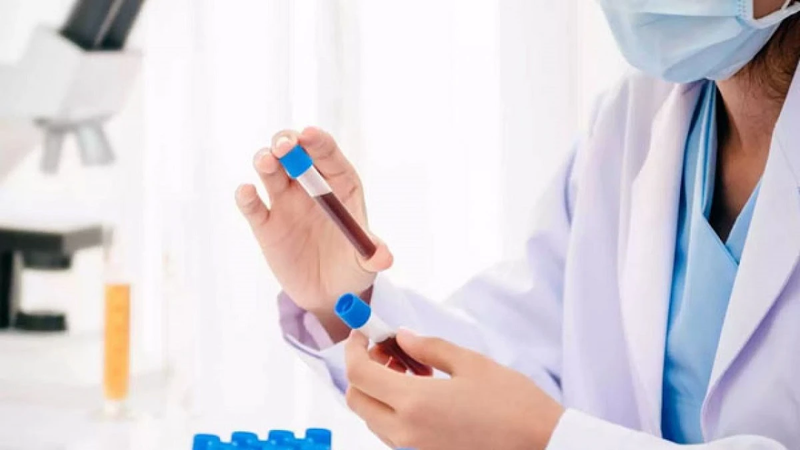 Giải đáp thắc mắc: DCP là gì? Xét nghiệm DCP có ý nghĩa như thế nào?