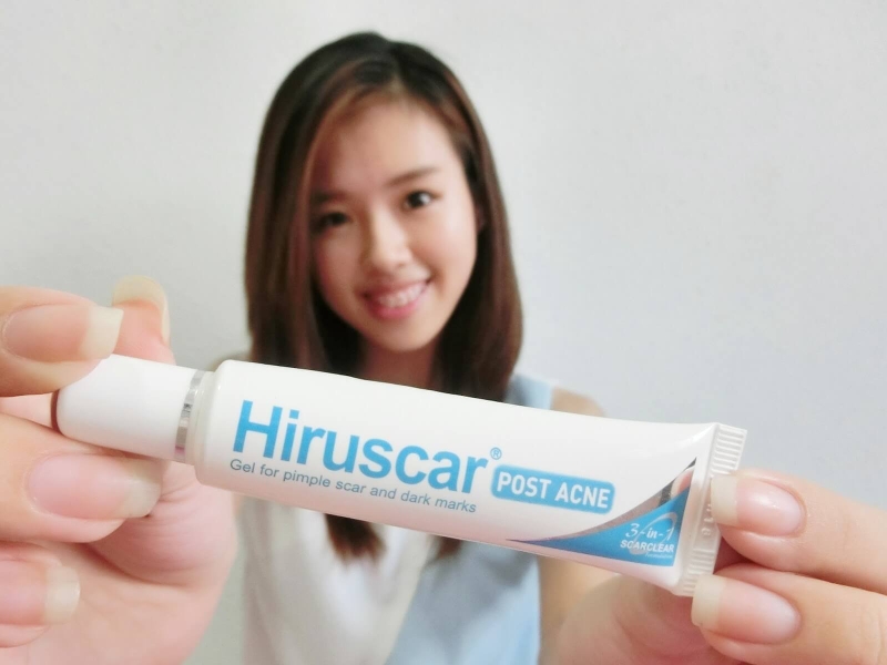 Giải đáp thắc mắc: Hiruscar Post Acne có trị mụn không? 1