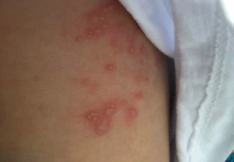 giai-dap-thac-maGiải đáp thắc mắc: Kiến ba khoang cắn có lây không? 2c-kien-ba-khoang-can-co-lay-khong-2.jpg