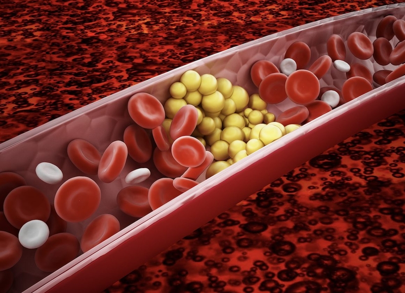 giai-dap-thac-mac-me-den-va-me-trang-loai-nao-tot-hon 1.jpg