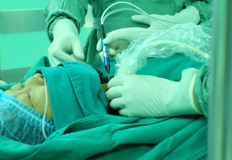 Giải đáp thắc mắc: Mổ bướu cổ xong nên ăn gì? 1