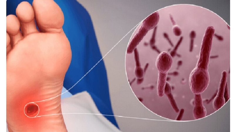 Giải đáp thắc mắc: Nên tiêm uốn ván mũi 2 cách mũi 1 bao lâu - 1