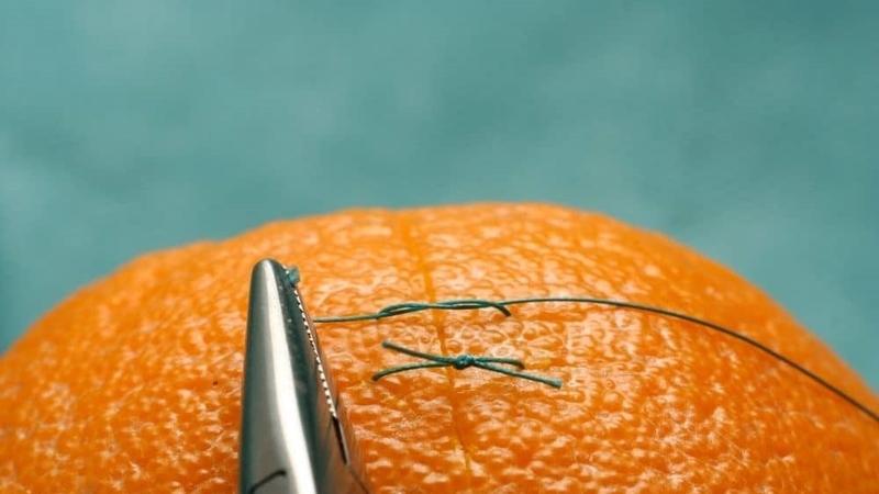 Giải đáp thắc mắc: Rách tầng sinh môn có tự lành không?2