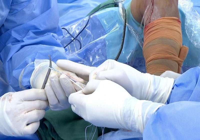 Giải đáp thắc mắc: Sau mổ dây chằng bao lâu thì quan hệ được? 2