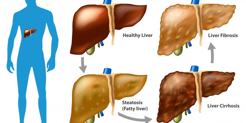 Giải đáp thắc mắc: SGOT trong xét nghiệm máu là gì? 2