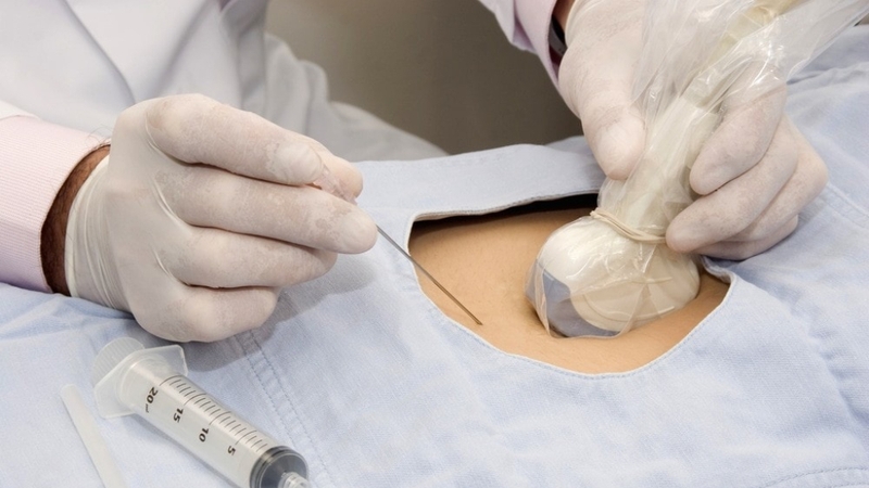 Giải đáp thắc mắc: Siêu âm 12 tuần đã biết trai hay gái chưa 3