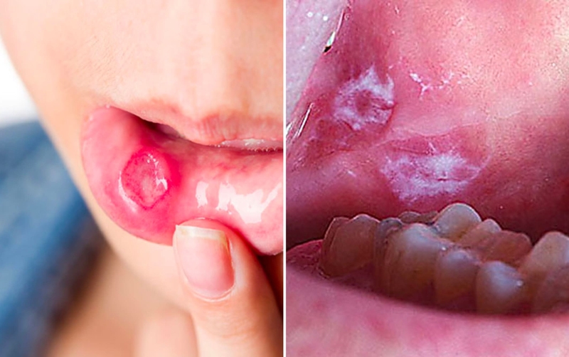 giai-dap-thac-mac-sui-mao-ga-thuong-moc-o-dau 2.jpg