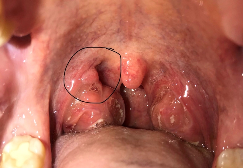 giai-dap-thac-mac-sui-mao-ga-thuong-moc-o-dau 3.jpg