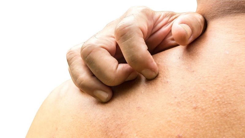 Giải đáp thắc mắc thiếu canxi có gây ngứa không? 1