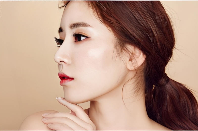 Giải đáp thắc mắc tiêm filler cằm bao lâu thì dặm lại được