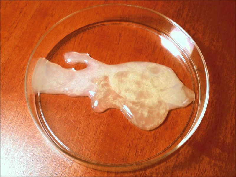 Tinh trùng vón cục làm suy giảm chất lượng tinh trùng