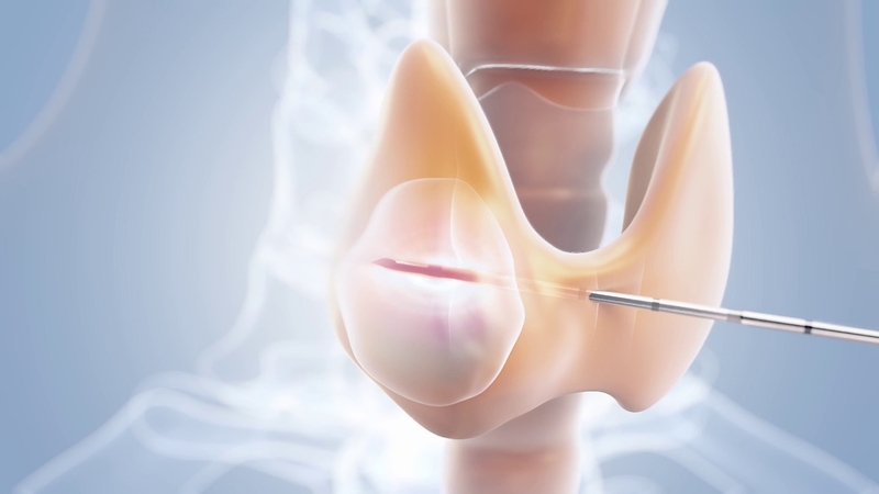 giai-dap-thac-mac-u-tuyen-giap-co-an-duoc-gia-do-khong 1.jpg