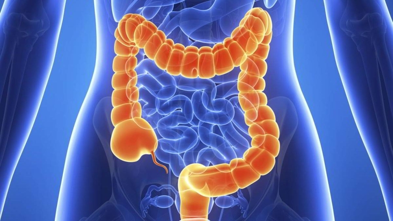 Giải đáp thắc mắc: Ung thư đại tràng giai đoạn 3 sống được bao lâu? 2