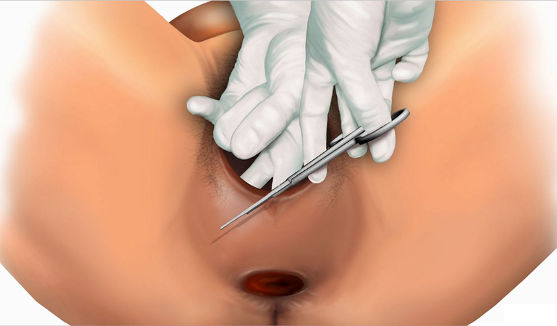 Giải đáp thắc mắc: Vết rạch tầng sinh môn bao lâu thì lành?1