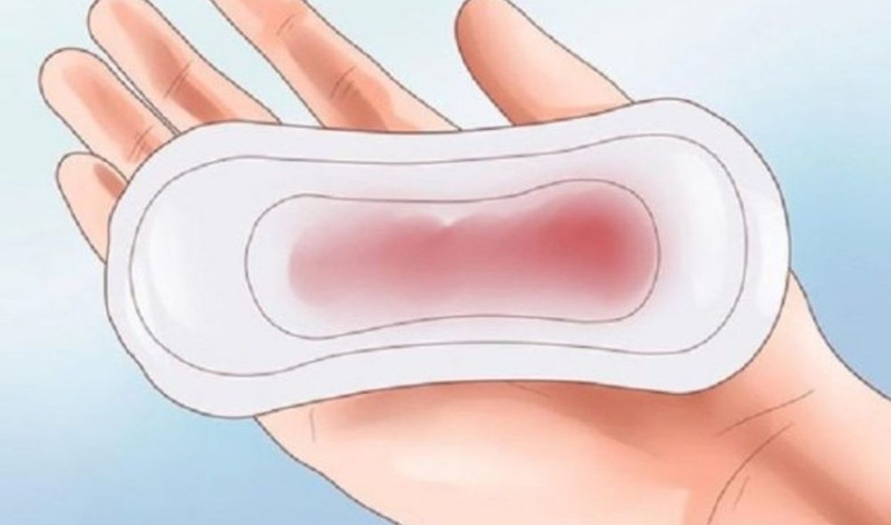 Giải đáp thắc mắc: Viêm lộ tuyến có gây ung thư không? 3