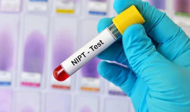 Giải đáp thắc mắc: Xét nghiệm ADN bao lâu có kết quả? 1