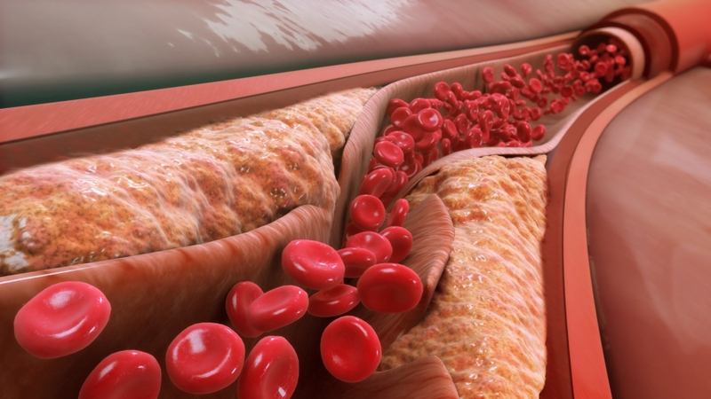 Giải đáp thắc mắc: Xét nghiệm cholesterol toàn phần là gì?