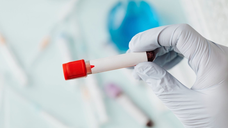 Giải đáp thắc mắc: Xét nghiệm nước tiểu có biết mang thai không? 3