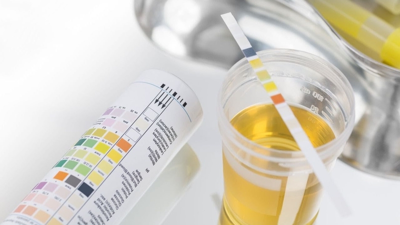 Giải đáp thắc mắc: Xét nghiệm nước tiểu có biết mang thai không? 4