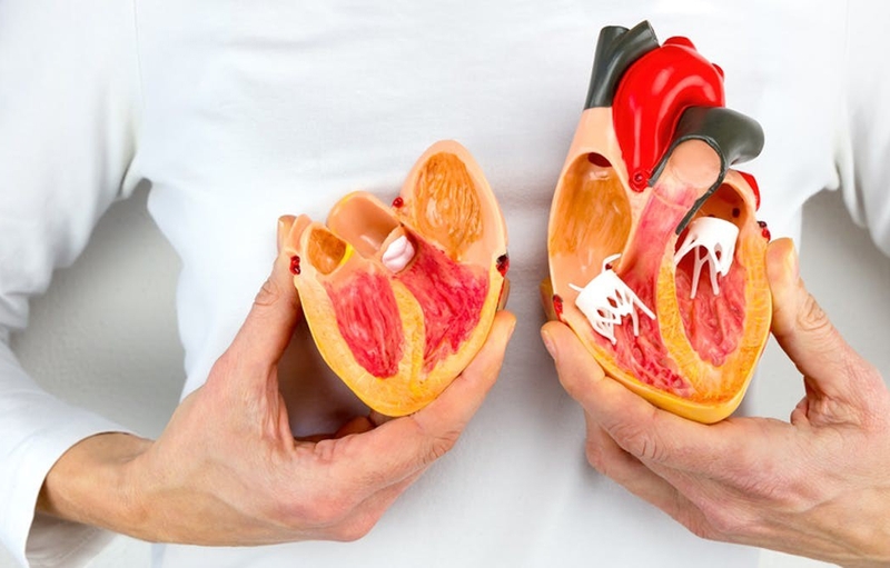 Giải đáp thông tin: Vì sao hẹp van 2 lá gây suy tim phải? 1