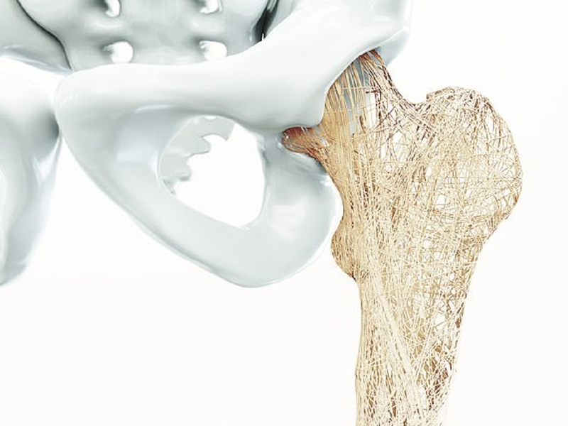 Giải đáp: Trào ngược dạ dày có ăn được mì tôm không? 3