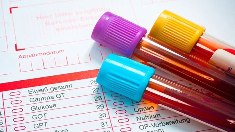 Giải đáp: Trước khi xét nghiệm máu có được ăn không 2