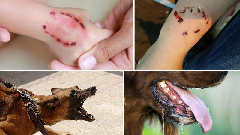 Nhiều người bị chó mèo cắn, cào thắc mắc xét nghiệm bệnh dại có chính xác không?