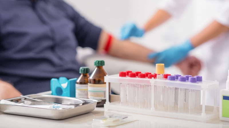 Xét nghiệm máu chỉ hỗ trợ chẩn đoán bệnh dại