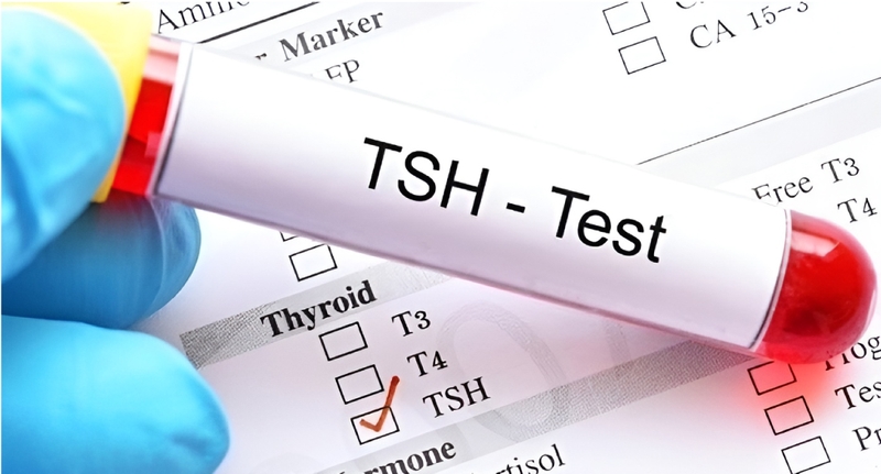 Giải đáp: Xét nghiệm máu bướu cổ có cần nhịn ăn hay không? 2