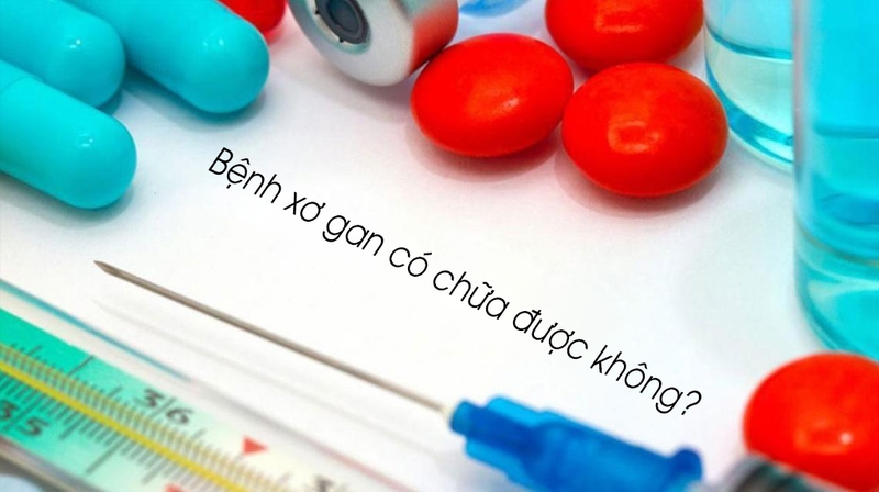 Giải đáp: Xơ gan có chữa được không? Cách điều trị xơ gan là gì? 3