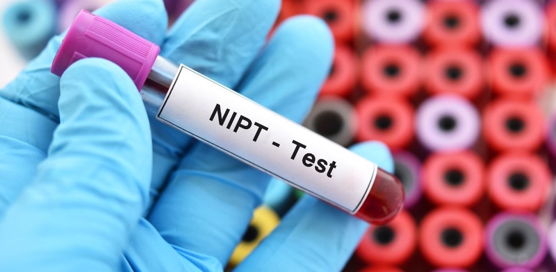 Giải đáp y khoa: Xét nghiệm NIPT rồi có cần làm thêm Double Test không? 2