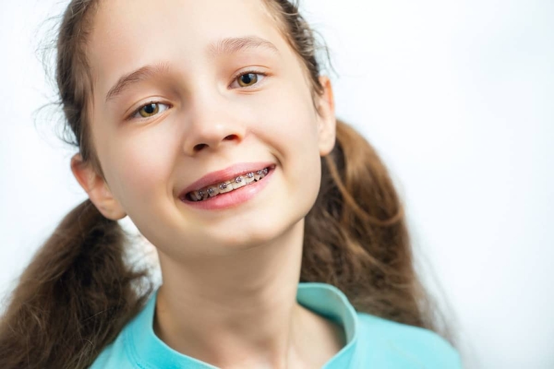 Giai đoạn vàng để niềng răng cho trẻ là khi nào? - 4