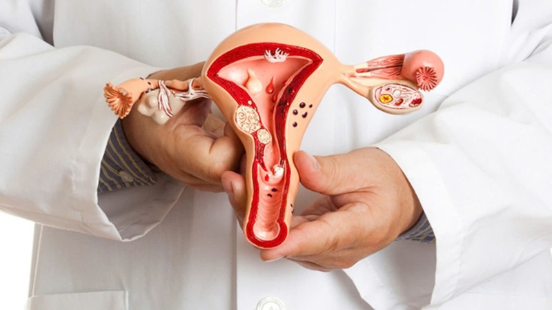 Giải mã hiện tượng bụng có cục cứng sau sinh thường 3