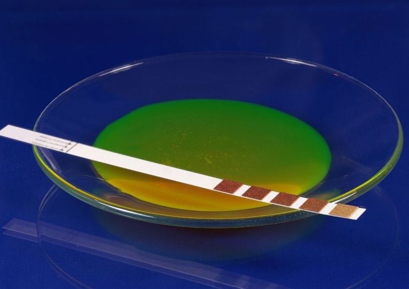 Giải mã nguyên nhân que thử rụng trứng lúc nào cũng lên 2 vạch 2